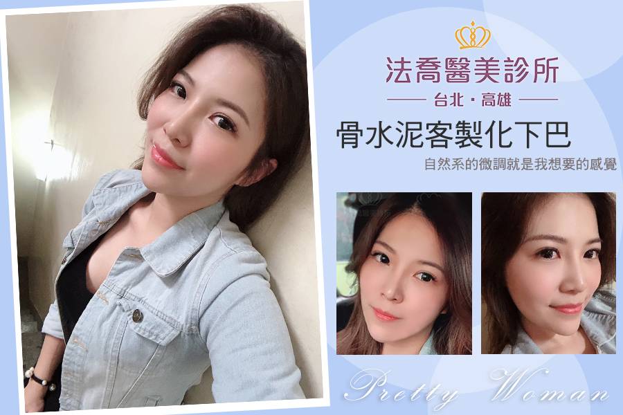 法喬醫美診所-骨水泥下巴