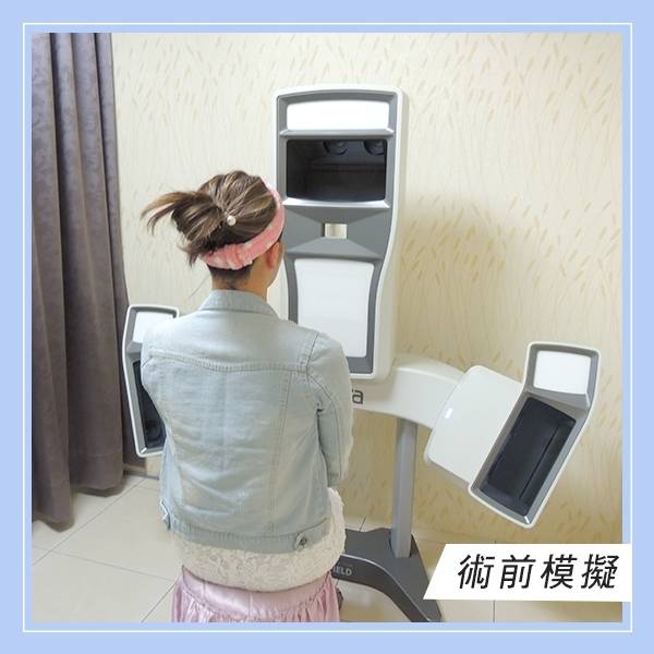 法喬醫美診所_3D模擬下巴