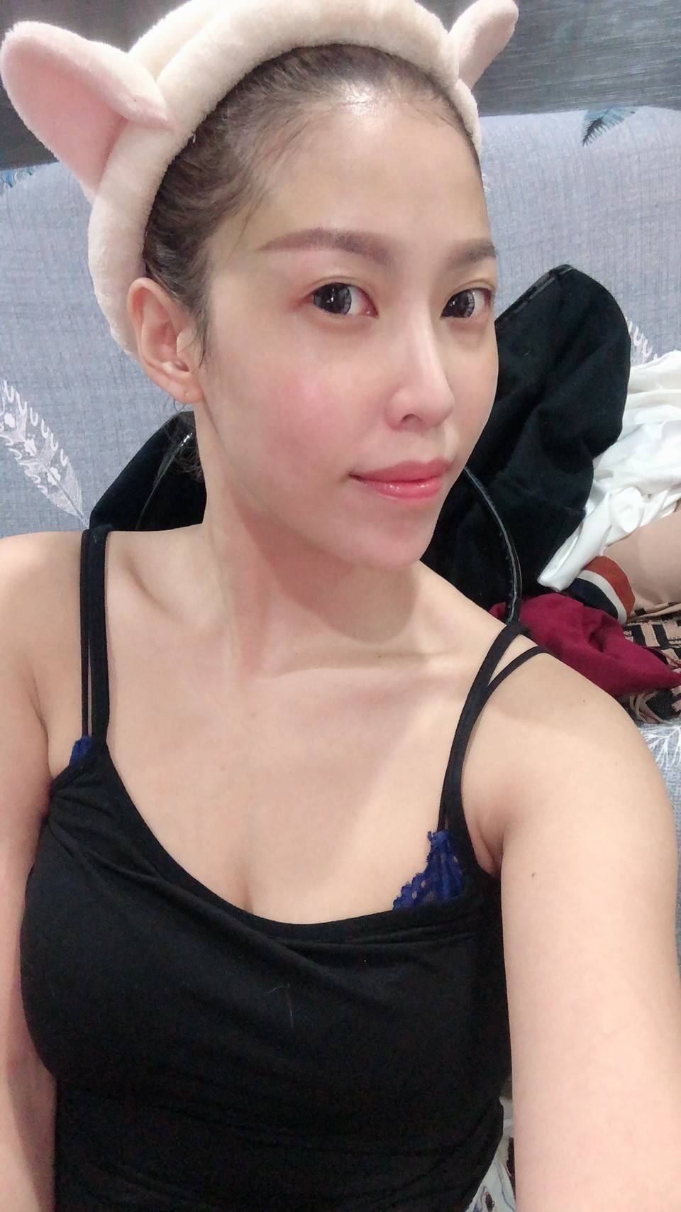 法喬醫美診所_微整就找張慈恩醫師
