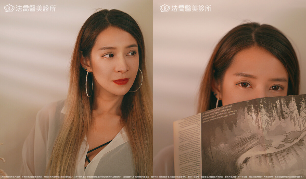 眼袋內開、脂肪移位 / 術後3個月