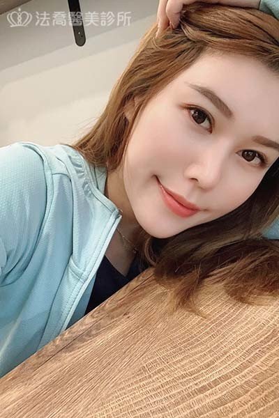 自體肋骨隆鼻