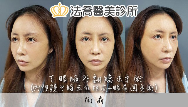 法喬醫美診所 邱浚彥醫師