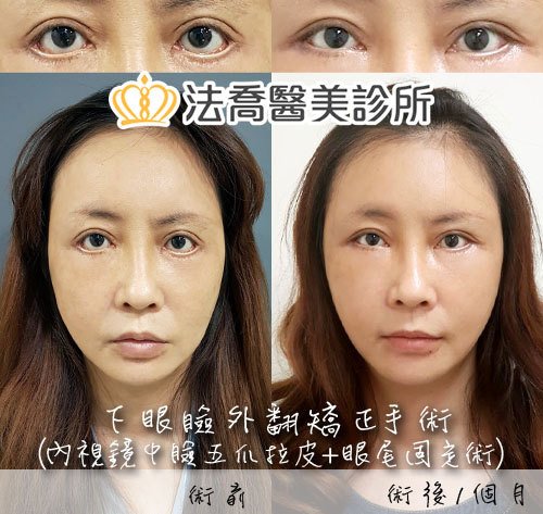 法喬醫美診所 邱浚彥醫師