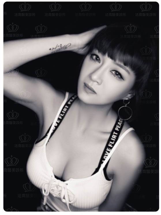 法喬醫美診所_複合式隆乳+果凍矽膠隆乳+自體脂肪豐胸+大腿環抽