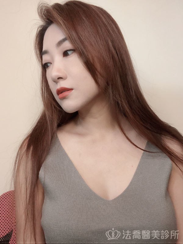 法喬醫美診所_複合式隆乳+威塑腹雕