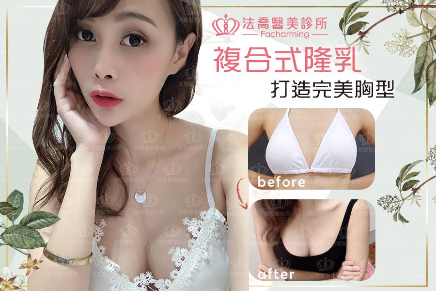 法喬醫美診所_複合式隆乳