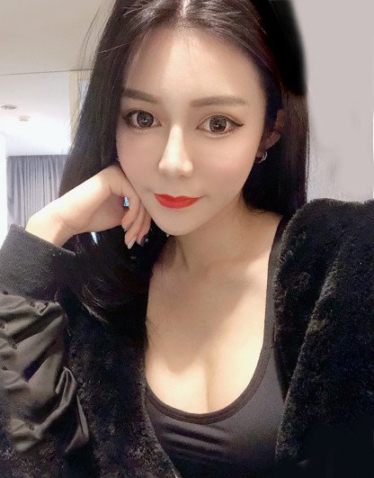 法喬醫美隆乳術後30天