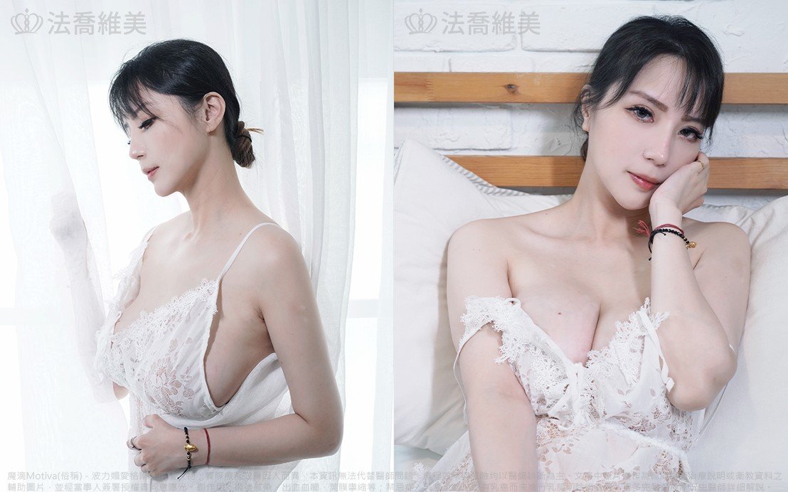 法喬醫美診所,邱浚彥,魔滴隆乳,隆乳推薦