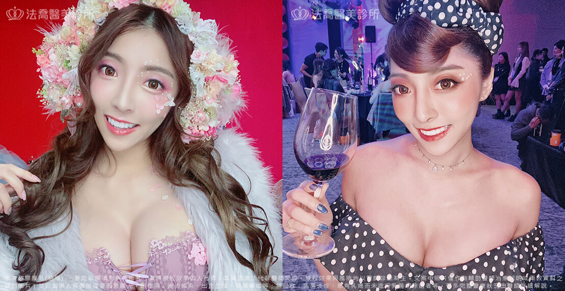 法喬醫美診所,邱浚彥,隆乳推薦