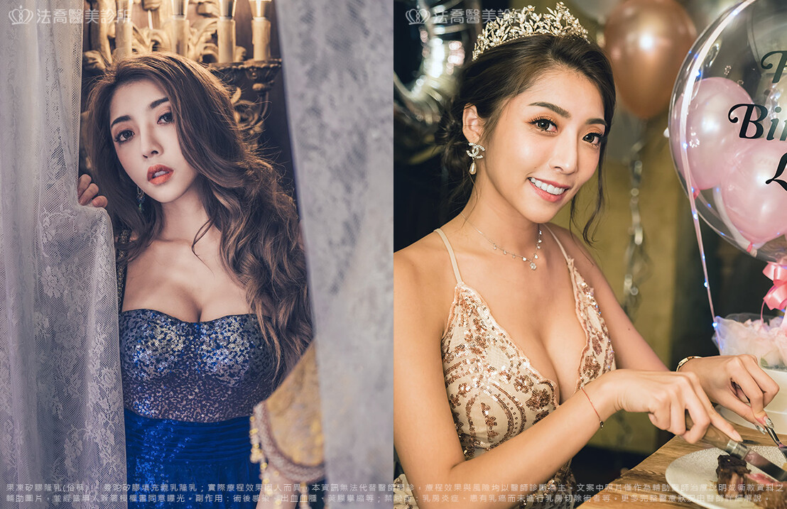 法喬醫美診所,邱浚彥,隆乳推薦