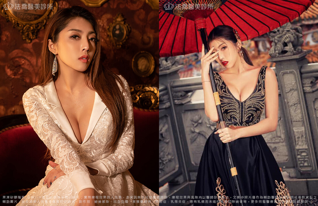 法喬醫美診所,邱浚彥,隆乳推薦