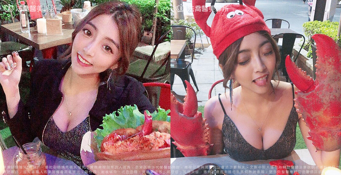 法喬醫美診所,邱浚彥,魔滴隆乳,隆乳推薦