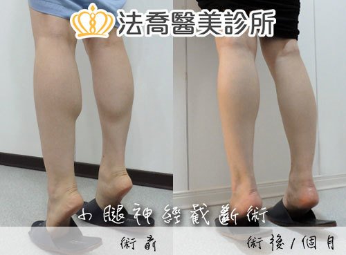 法喬醫美診所 邱浚彥醫師