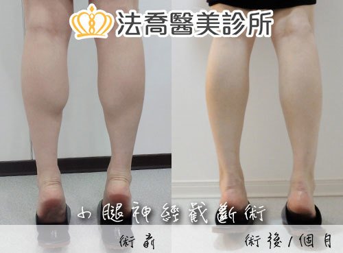 法喬醫美診所 邱浚彥醫師
