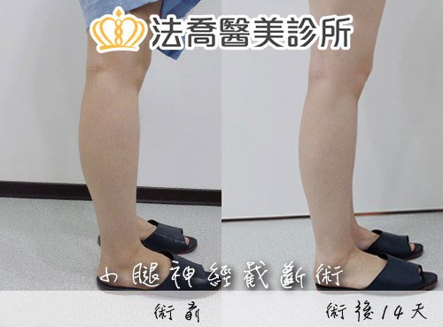 法喬醫美診所 邱浚彥醫師