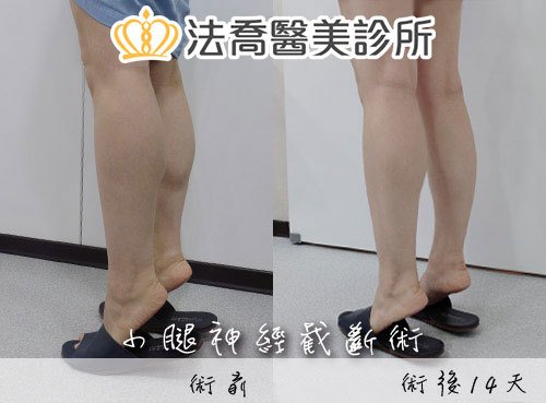 法喬醫美診所 邱浚彥醫師