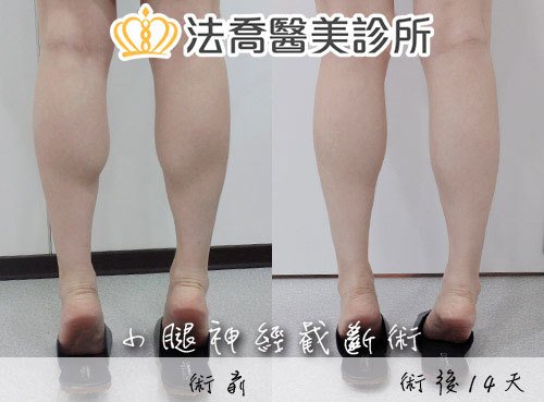 法喬醫美診所 邱浚彥醫師