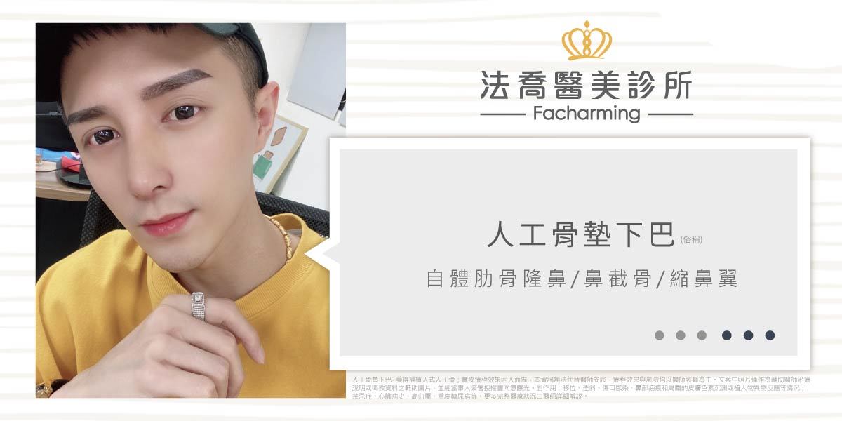 法喬醫美診所,邱浚彥,墊下巴