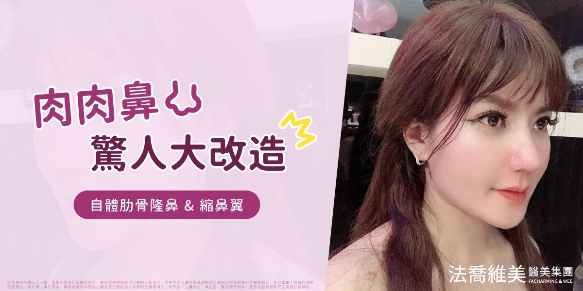YOYO肋骨隆鼻案例首圖