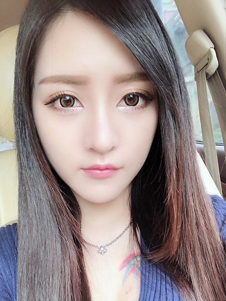 法喬醫美診所術後3個月案例