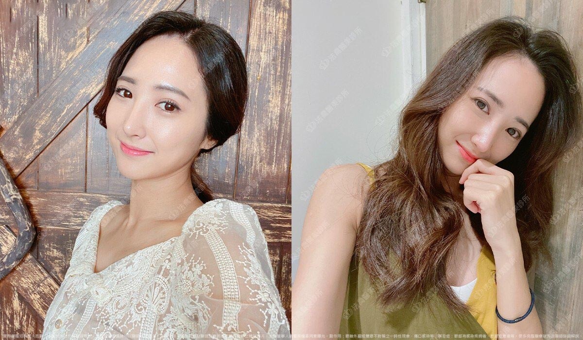 術後6個月生活照