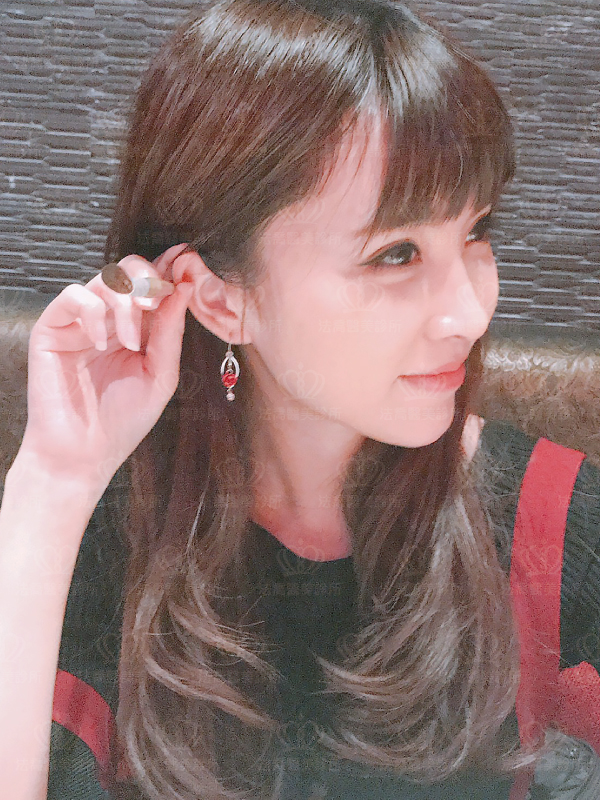 自體肋骨隆鼻