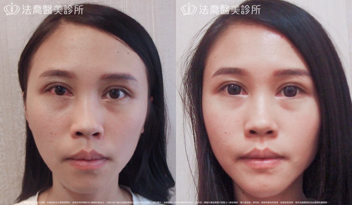 法喬醫美診所 邱浚彥醫師