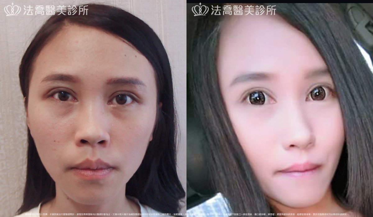 法喬醫美診所 邱浚彥醫師