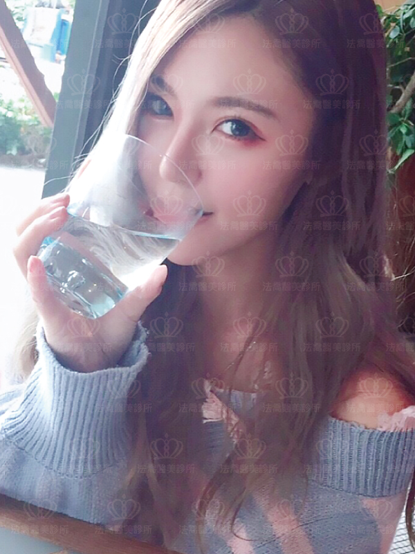 自體肋骨隆鼻