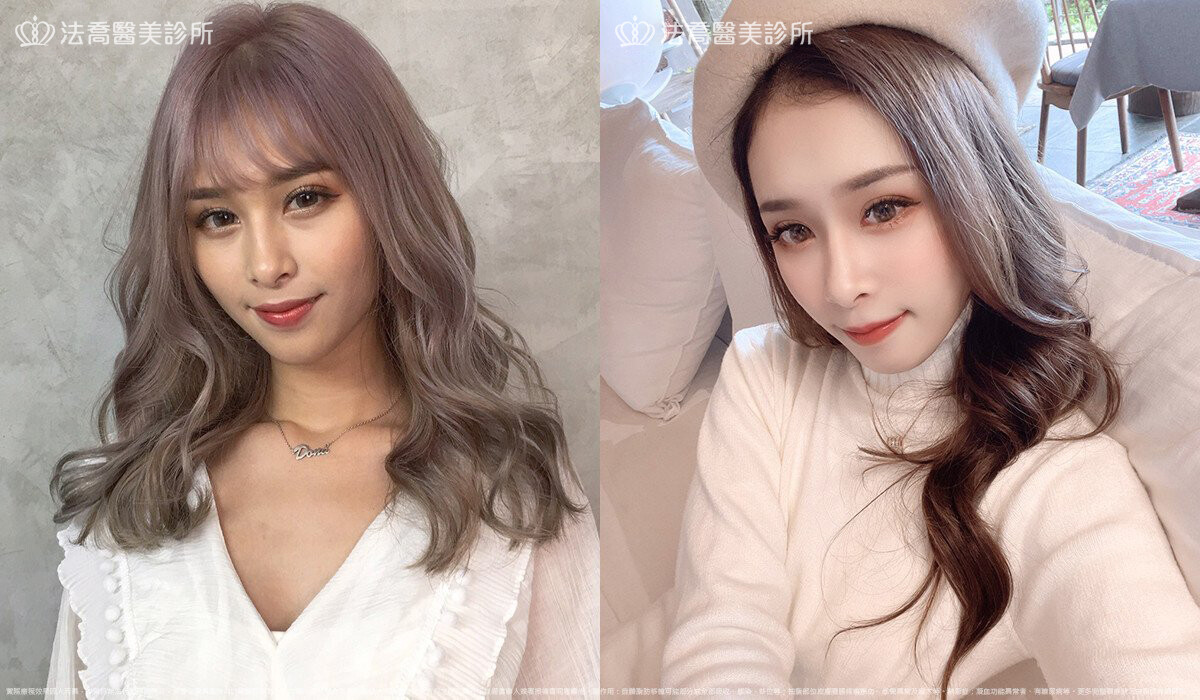 法喬醫美診所,邱浚彥,自體脂肪豐臉