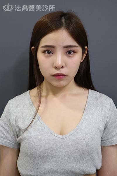 法喬醫美診所 邱浚彥醫師