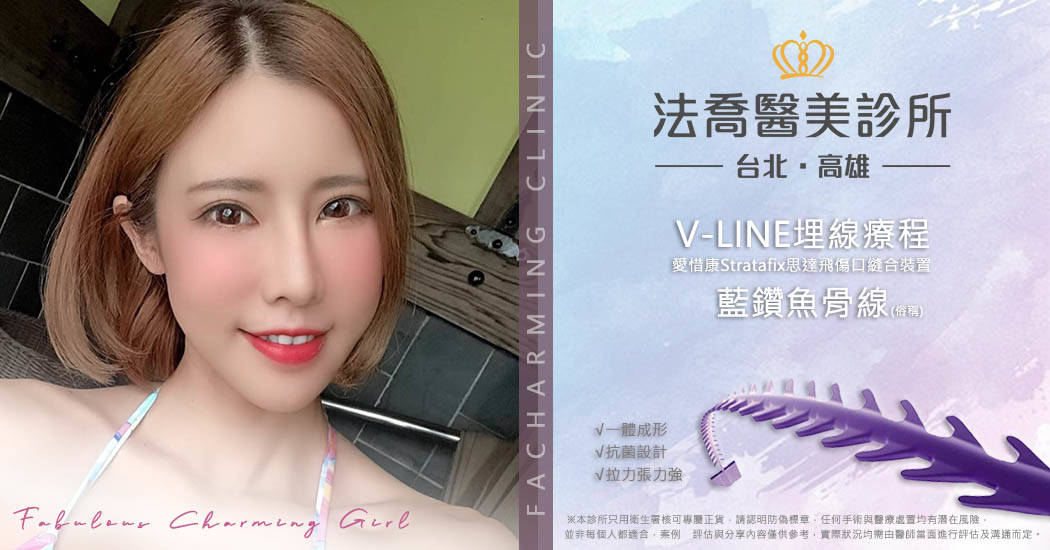 法喬醫美診所藍鑽魚骨線埋線拉提術後2周案例照