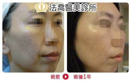 法喬醫美診所 邱浚彥醫師