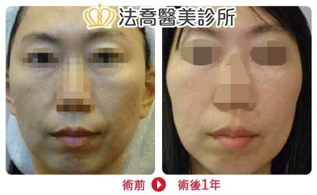 法喬醫美診所 邱浚彥醫師