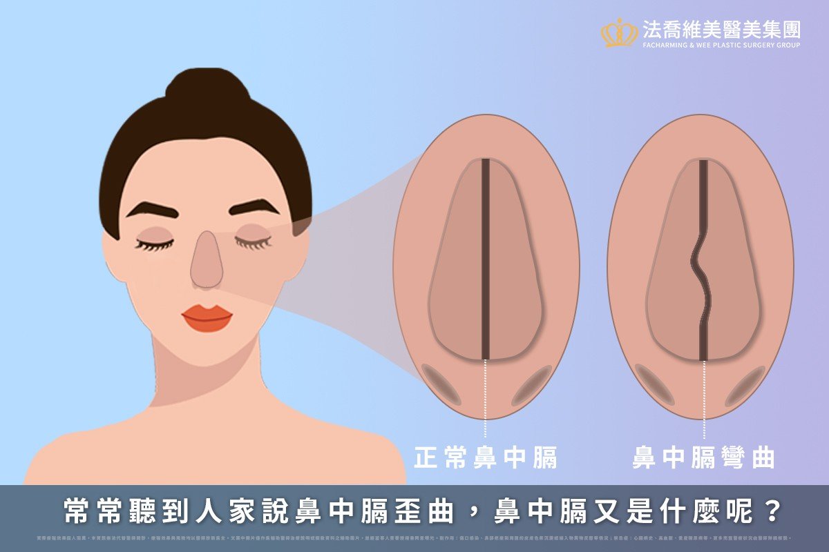 鼻中膈彎曲